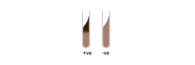 Read more about the article Esculin Hydrolysis Test: Principle, Procedure, Purpose, and Results