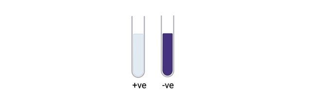 Read more about the article Hippurate Hydrolysis Test: Definition, Principle, Procedure, and Results