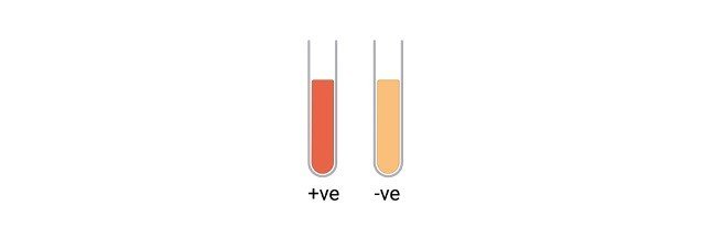 Read more about the article Methyl Red Test: Results, Procedure, and Principle