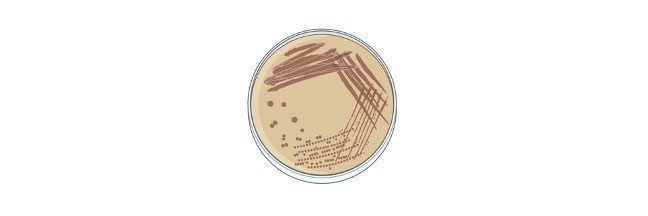 Lecithinase Test, Lecithinase Test Result, Lecithinase Test Principle, Lecithinase Test Procedure, Lecithinase Test Reagents