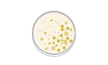 Potassium Hydroxide Test: Result, Principle, and Procedure