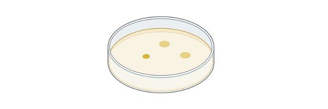 Read more about the article Potassium Hydroxide Test: Result, Principle, Procedure, and Reagents