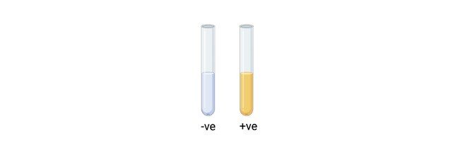 Read more about the article Salt Tolerance Test: Principle, Procedure, and Result