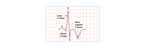 Read more about the article Cardiac Cycle: Definition, Anatomy, and Physiology