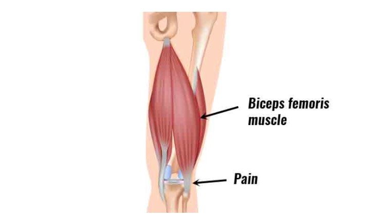 Biceps Femoris Diagram