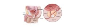Read more about the article Prostate Gland: Functions, Location, and Structure